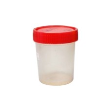 Healthcare Urine Culture Bottle